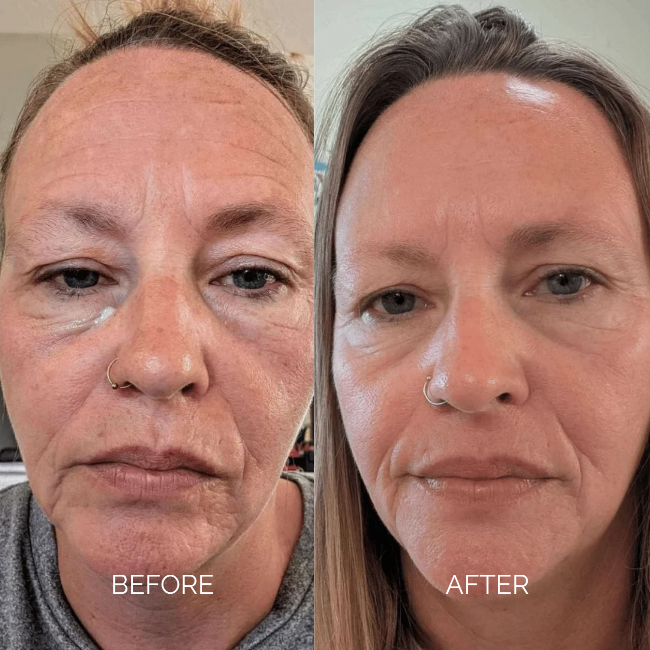 Sodium DNA Anti-Ageing Cream
