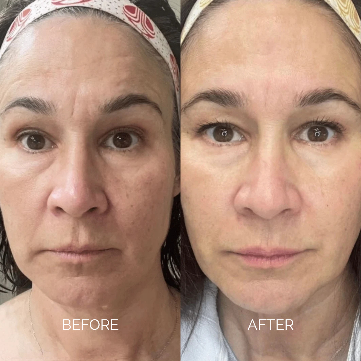 Sodium DNA Anti-Ageing Cream